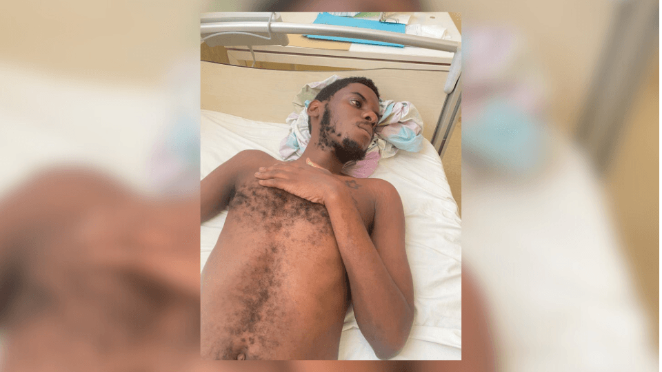 Urgence médicale : Segame Beatz en danger critique au CHU de Libreville