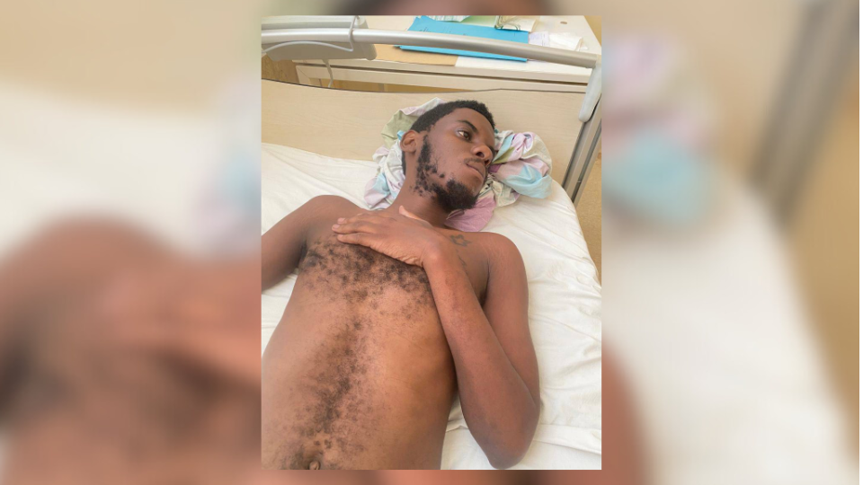 Urgence médicale : Segame Beatz en danger critique au CHU de Libreville